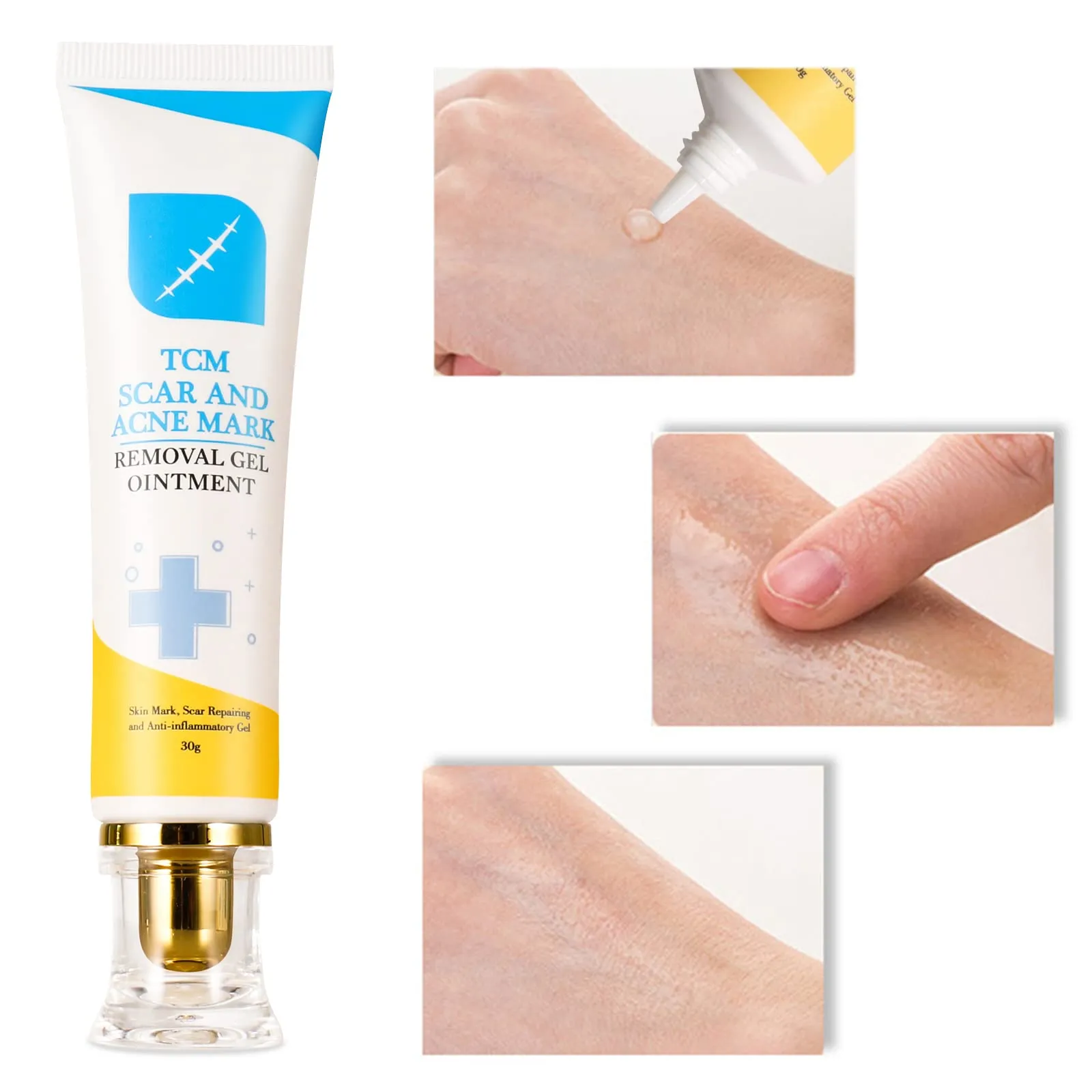 2pcs Scar and Acne Marks Removal Ointment Gel, Scar Removal Cream, Skin Repair Scars Burns Cuts, Stretch Marks, Acne Spots, Scar Gel 30gx2