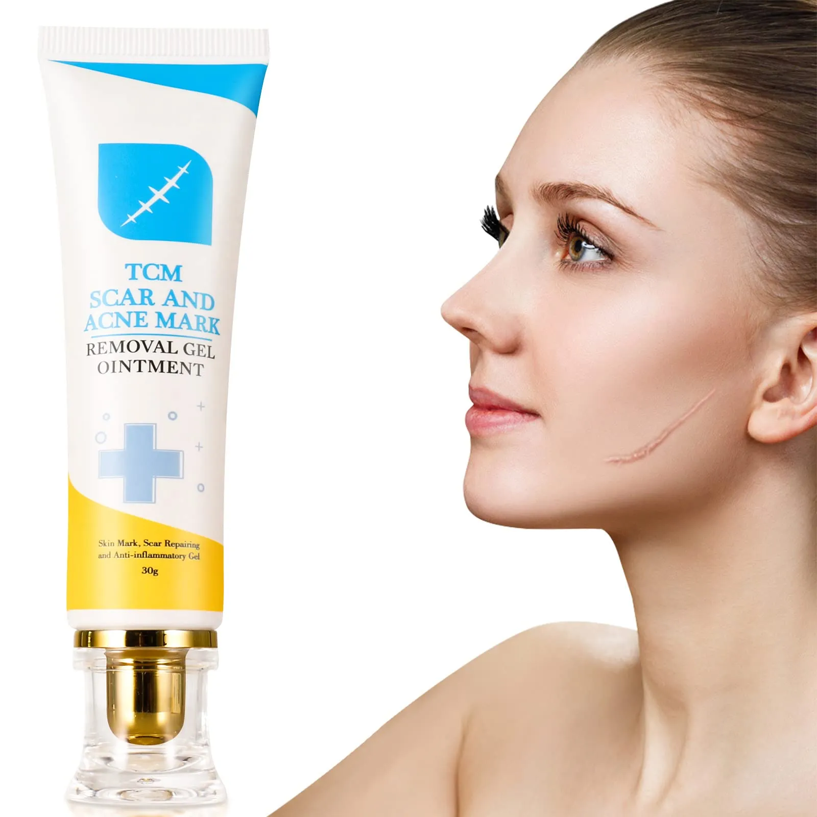 2pcs Scar and Acne Marks Removal Ointment Gel, Scar Removal Cream, Skin Repair Scars Burns Cuts, Stretch Marks, Acne Spots, Scar Gel 30gx2