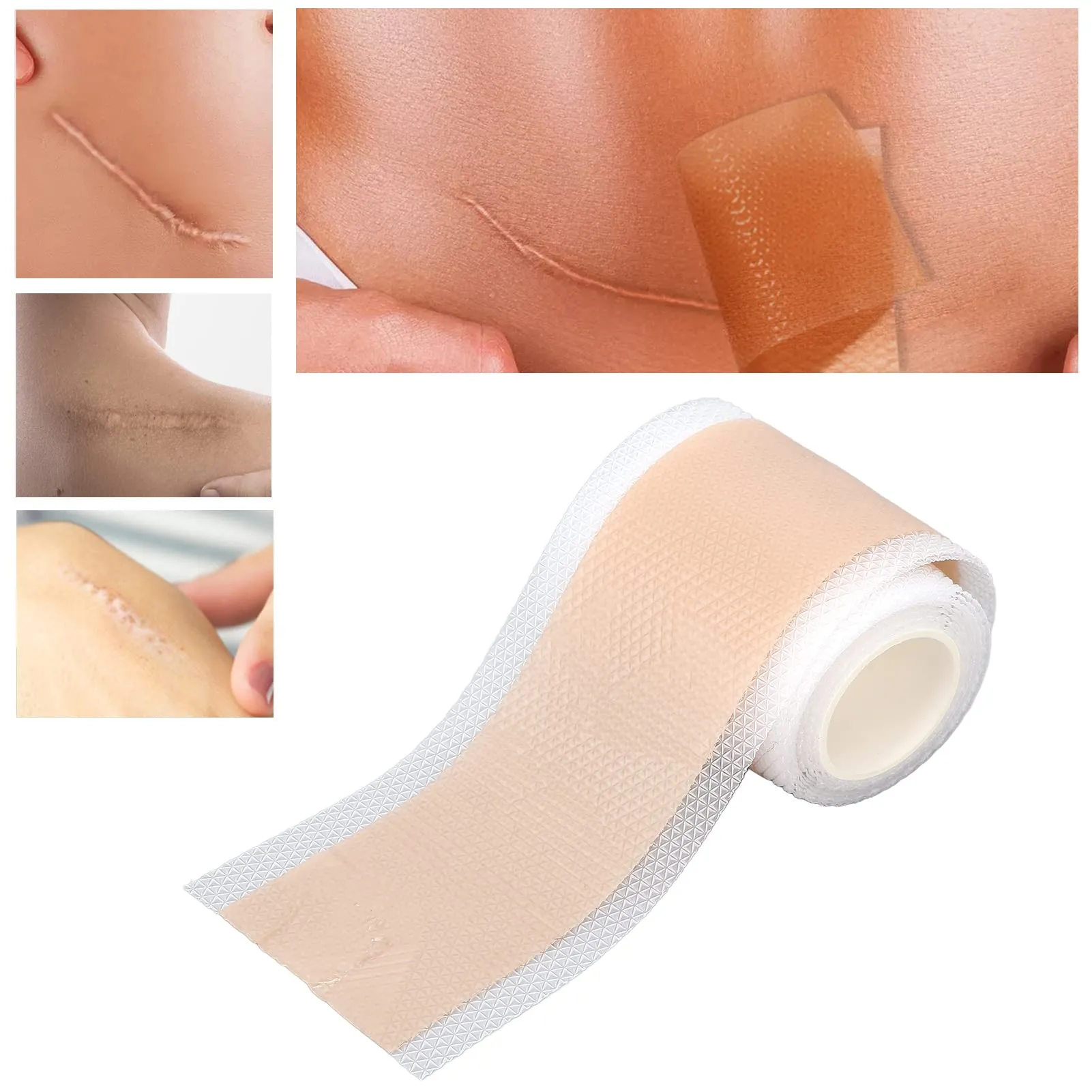 59in Silicone Scar Sheets, Self Adhesion Reusable Scar Removal Gel Tape for C Section, Post Surgery, Burns, Acne