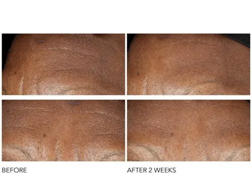 Advanced Retinol   Ferulic -- Intense Wrinkle Cream ** 60 ml | 2.0 oz