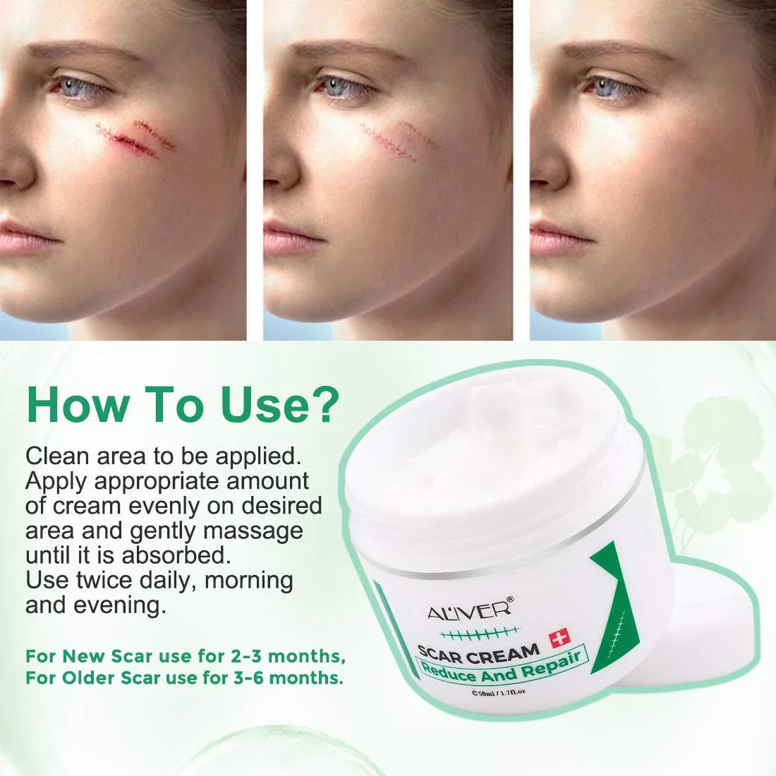 Aliver Scar Removal Cream for Old & New Scars, Stretch Mark Remover for Men & Women, Acne Scar Removal on Face or Body, Scar Treatment for Cuts,Surgery, Burn, Cut, Keloid, C-Section