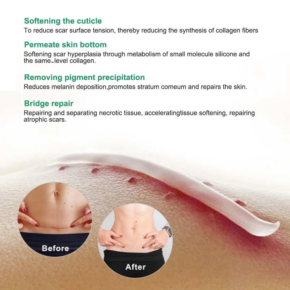 Aliver Scar Removal Cream for Old & New Scars, Stretch Mark Remover for Men & Women, Acne Scar Removal on Face or Body, Scar Treatment for Cuts,Surgery, Burn, Cut, Keloid, C-Section