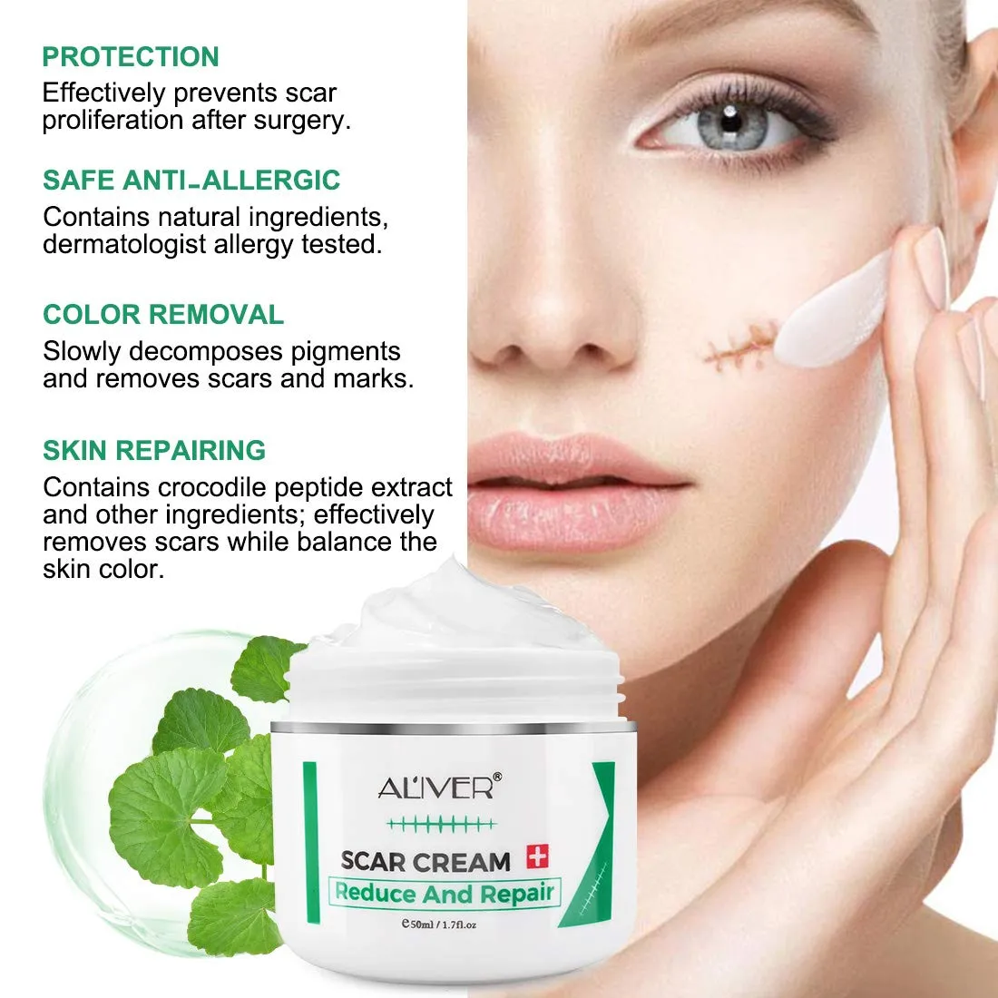 Aliver Scar Removal Cream for Old & New Scars, Stretch Mark Remover for Men & Women, Acne Scar Removal on Face or Body, Scar Treatment for Cuts,Surgery, Burn, Cut, Keloid, C-Section