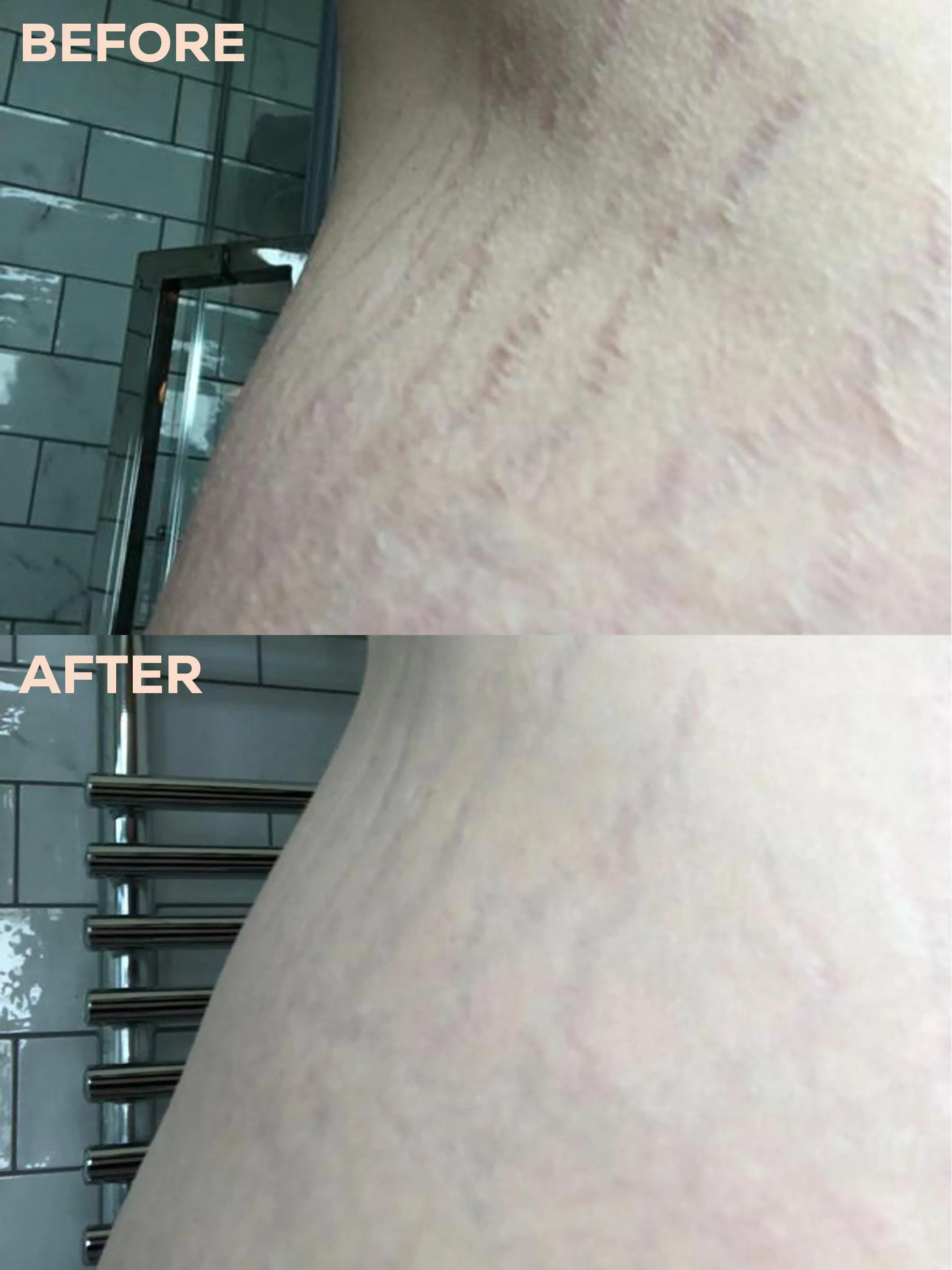 AND STRETCH... _ Stretch mark cream