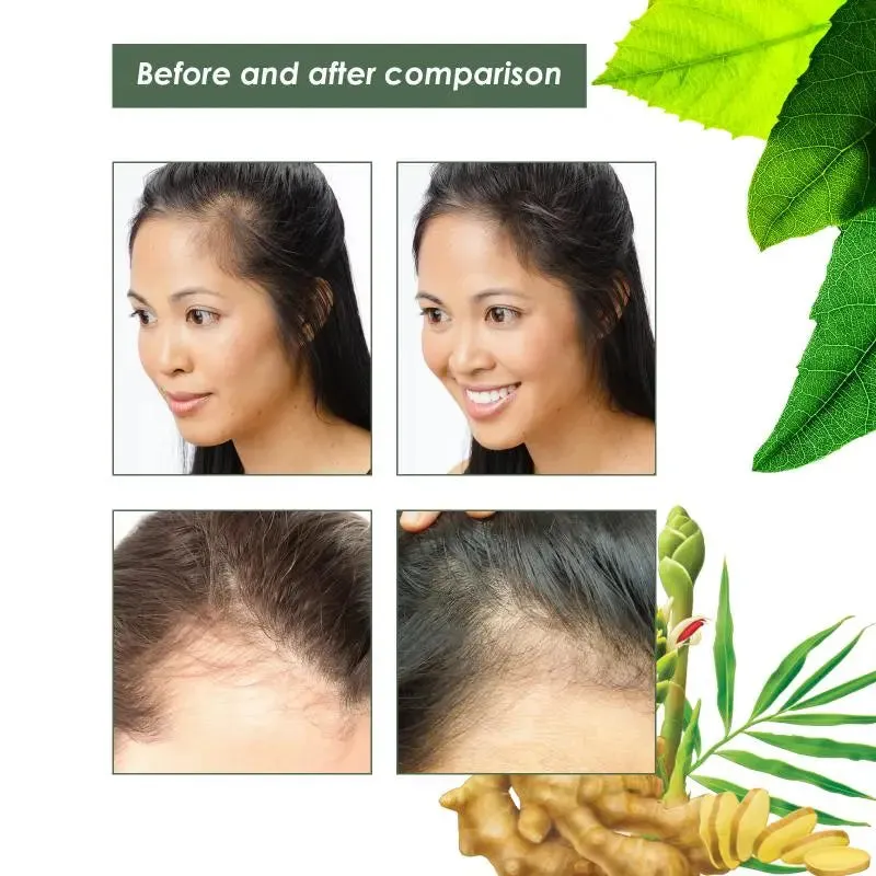 Anti-Hair Loss Ginger Shampoo