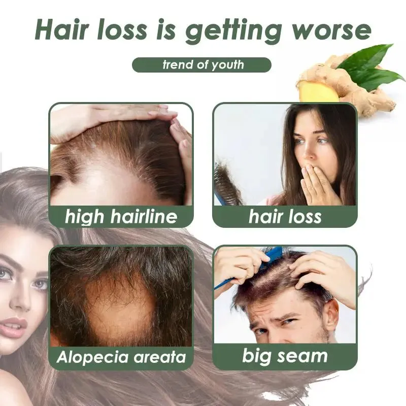 Anti-Hair Loss Ginger Shampoo