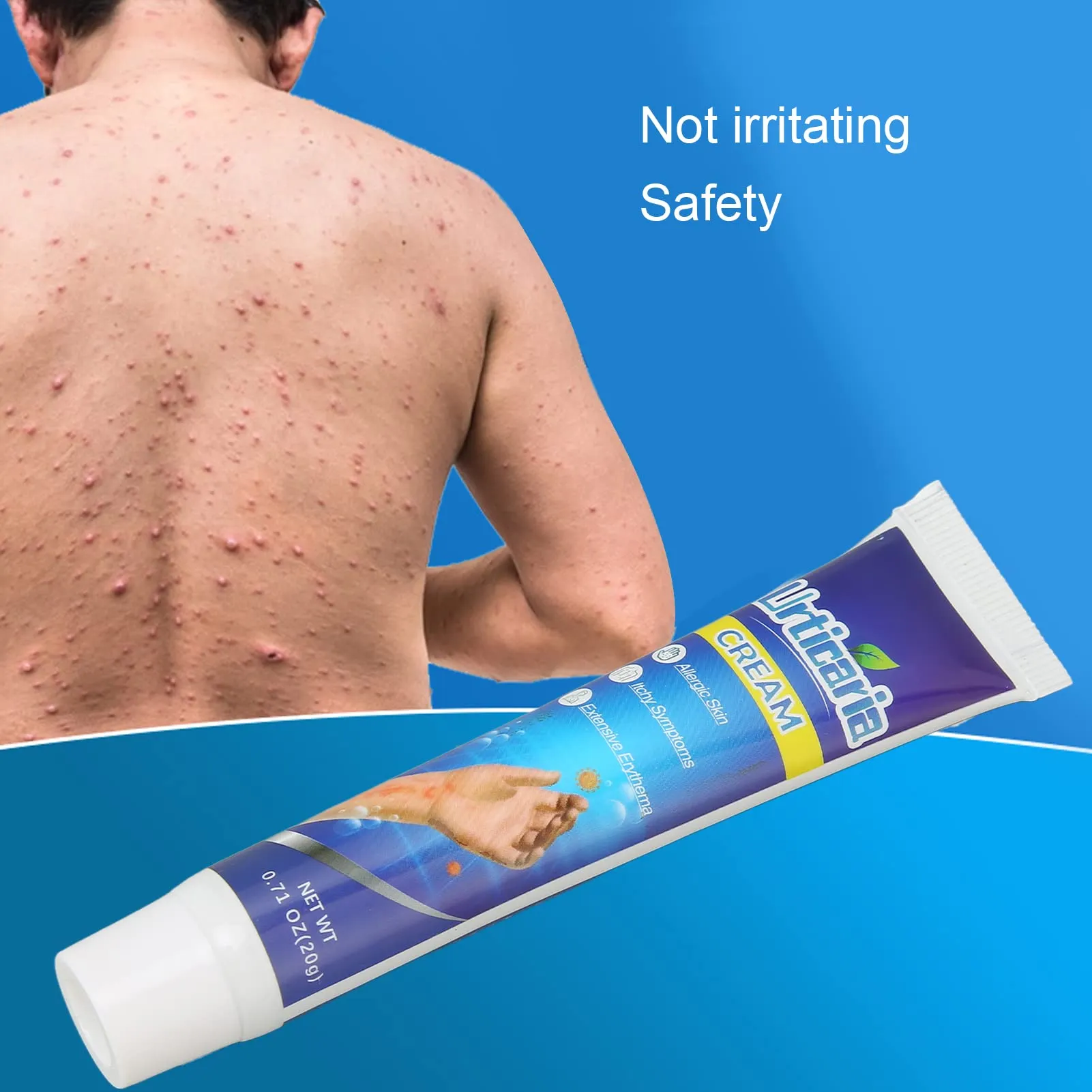Anti-itch Cream, Pain Relief Urticaria Relief, Itching Ointment Dry Skin Adjuvant Treatment Microbiome Maintenance 20g