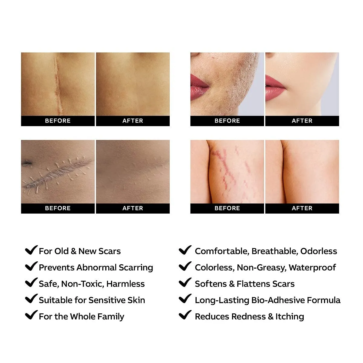 AZALLY Advanced Scar Gel - Scar Diminishing Serum - Reduces The Appearance of Old & New Scars - Best Scar Treatment for Repair Scars from Burns Cuts Acne Spots Stretch Marks