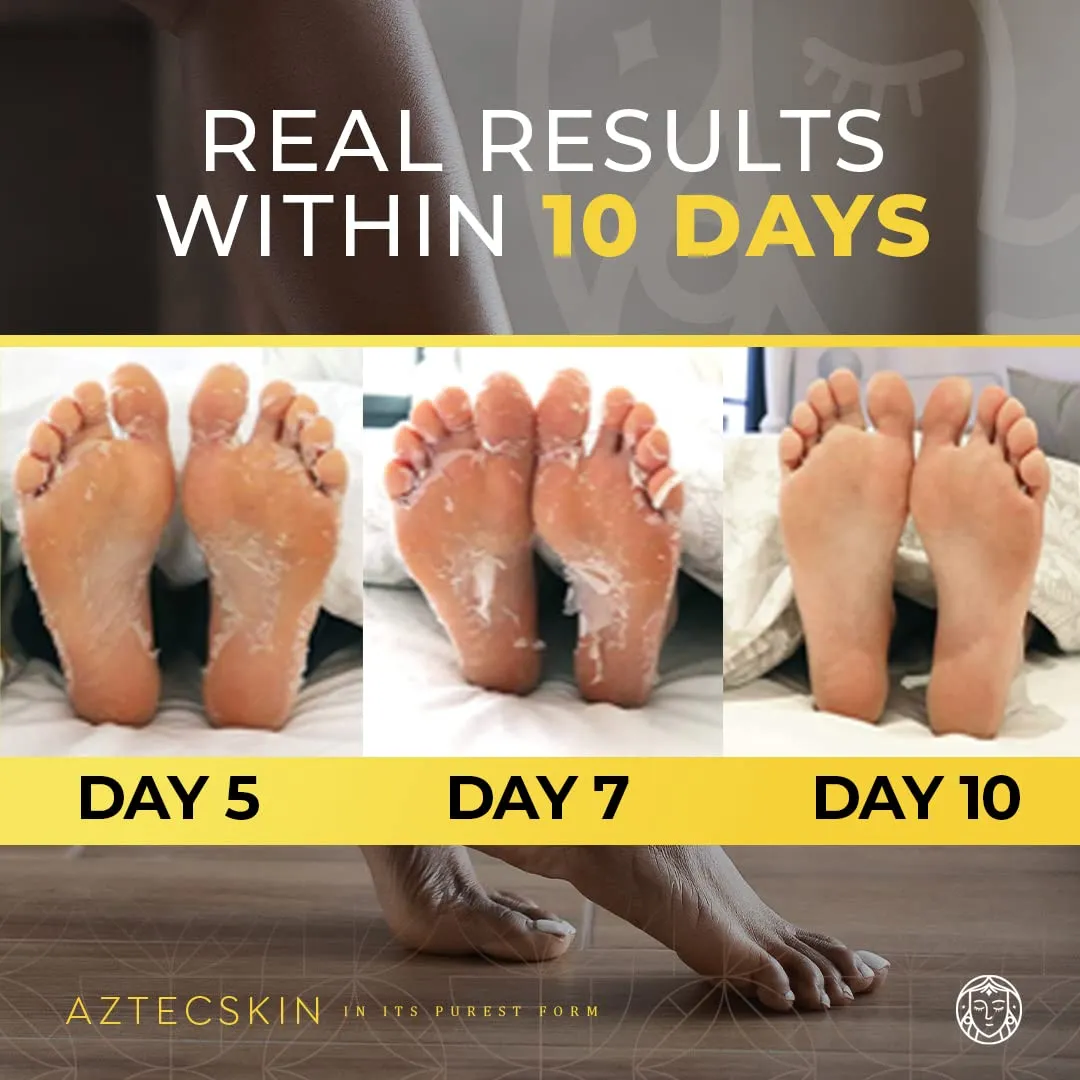 Aztecskin - Foot Peel Mask - Perfect For Callus, Cracked Heel And Hard Skin - Foot Mask For Exfoliating, Moisturising Treatment For Baby Soft Feet