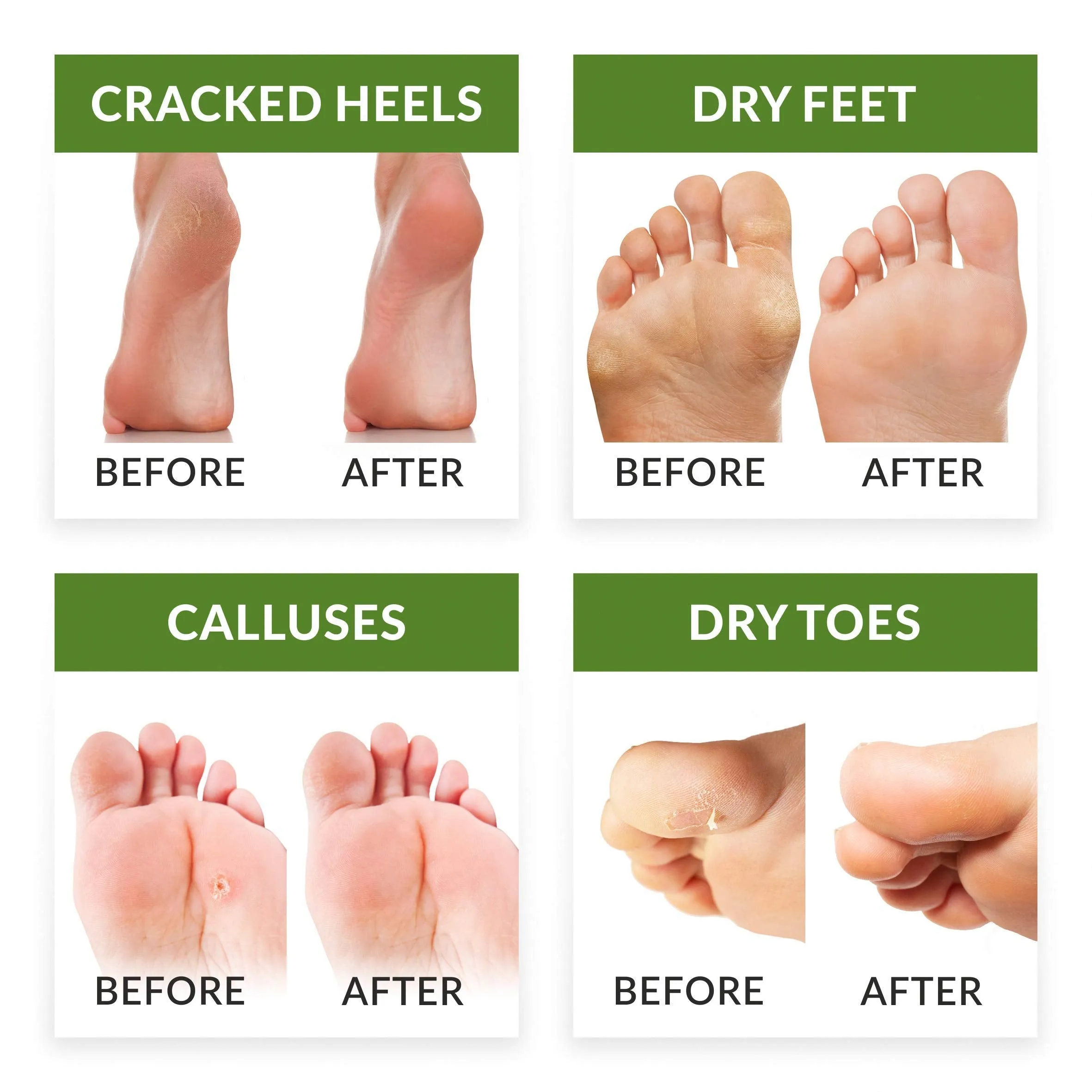 Baby Feet Foot Peel Mask Foot Masks remove hard skin Exfoliating Socks Callus Remover pedicure Exfoliator Foot Peeling Mask Foot Care Kit for cracked Feet Pack 2 Pairs (up to size W8/M8.5 EU43) Green