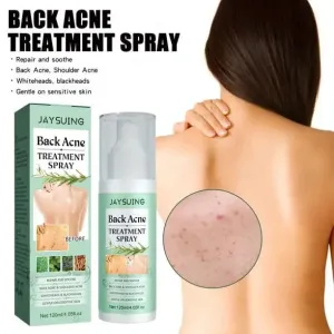 Back Acne Treatment Spray, 120ml