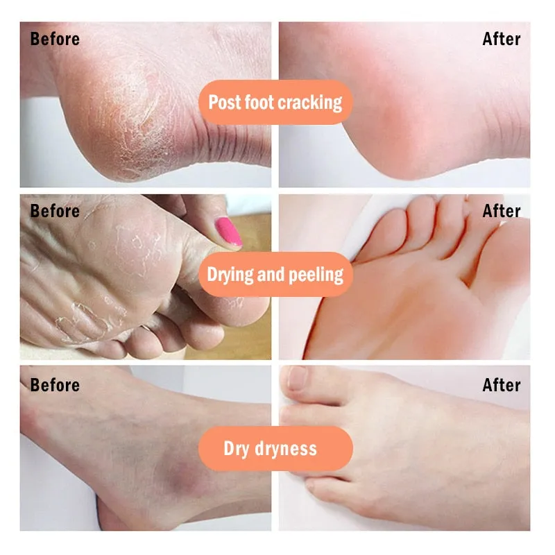Banana Cream Crack Heel Balm