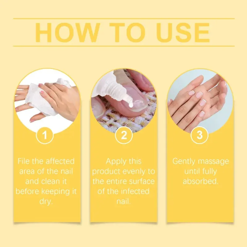 Bee Venom Fungal Nail Treatment
