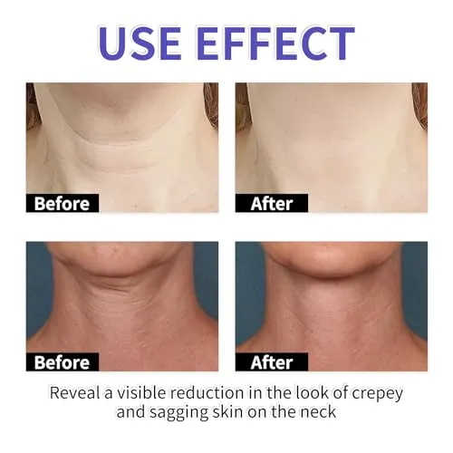 BEETUY Tighten and Lift Neck Cream, Hydrating Anti Wrinkles Tightening Sagging Skin Neck Tightening Cream. 50g (1 Pcs)