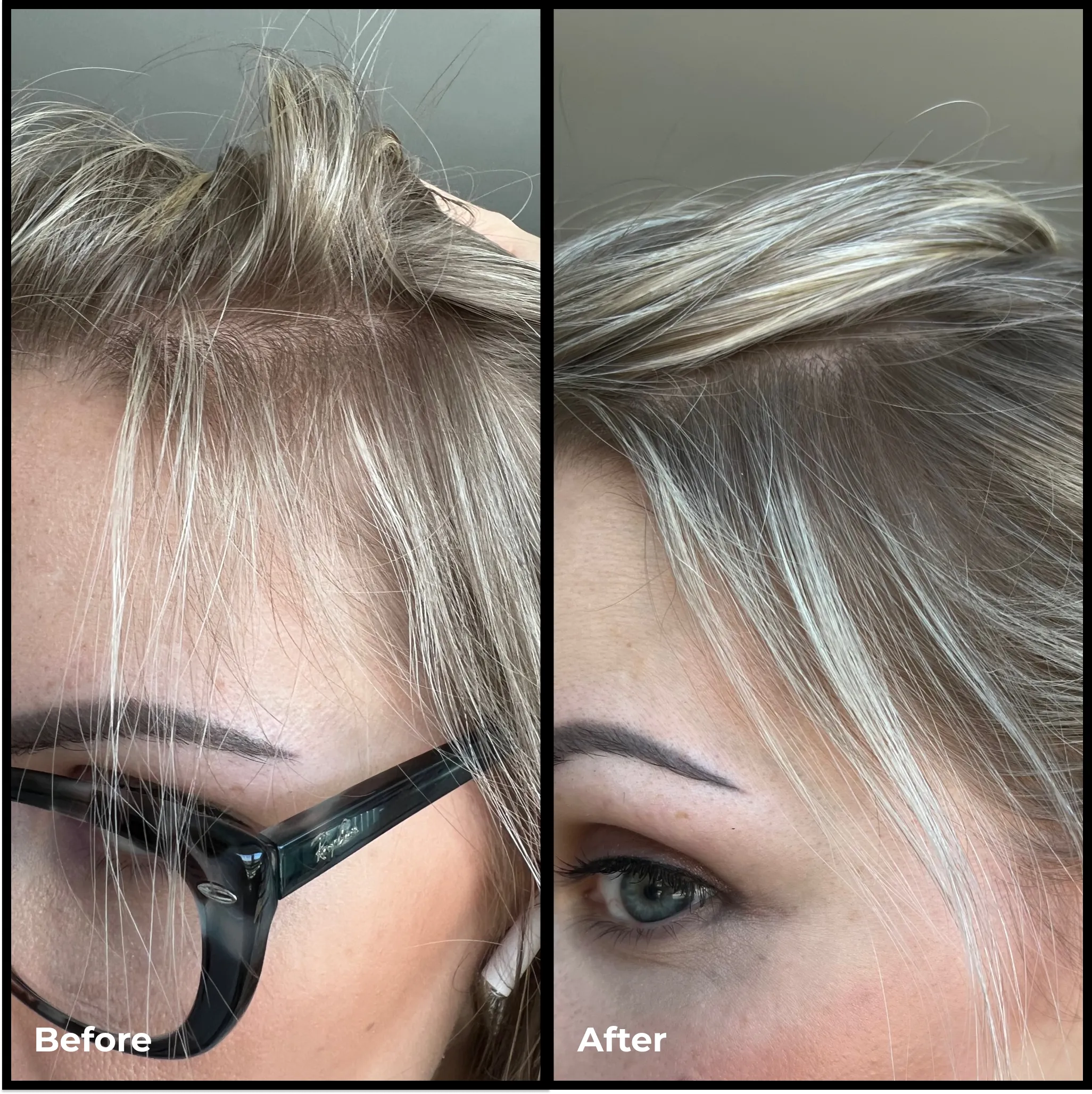 Better Roots RootBoost Serum