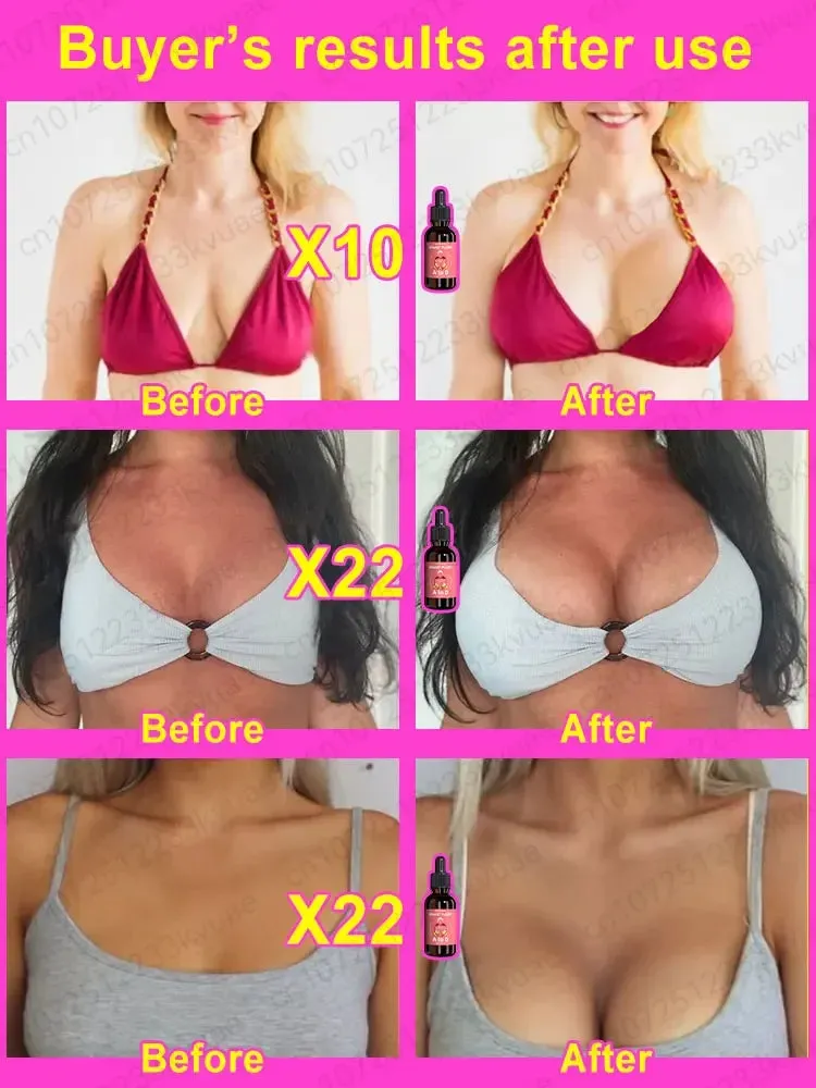 Breast Enhancement Oil - A Cup to D Cup Transformation, Promote Growth Naturally, Firming & Lifting Formula for Fuller, Perkier Curves!