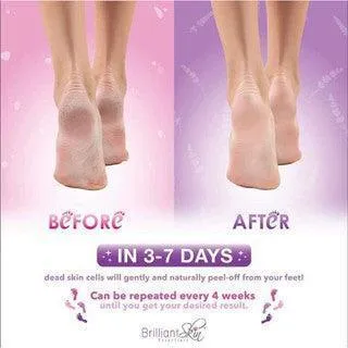Brilliant Skin Heel and Toe Milk Foot Mask (Pink)