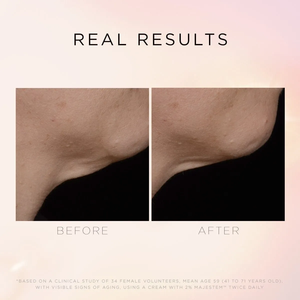 Cosmedix Illuminate & Lift Neck & Decollete