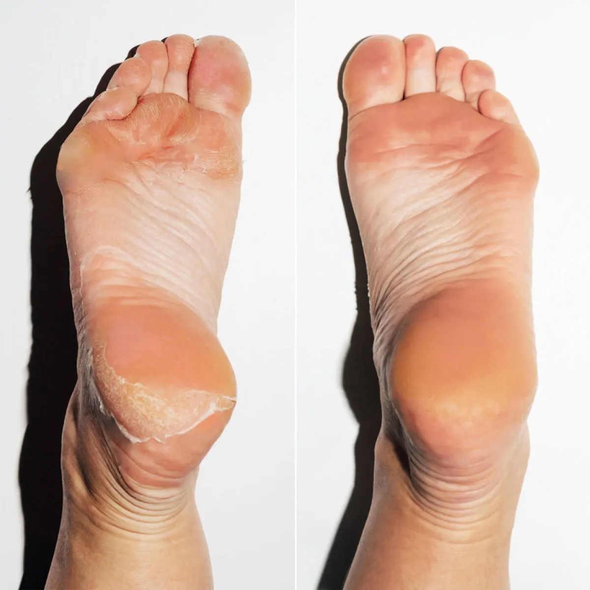 Dream Feet Bonus