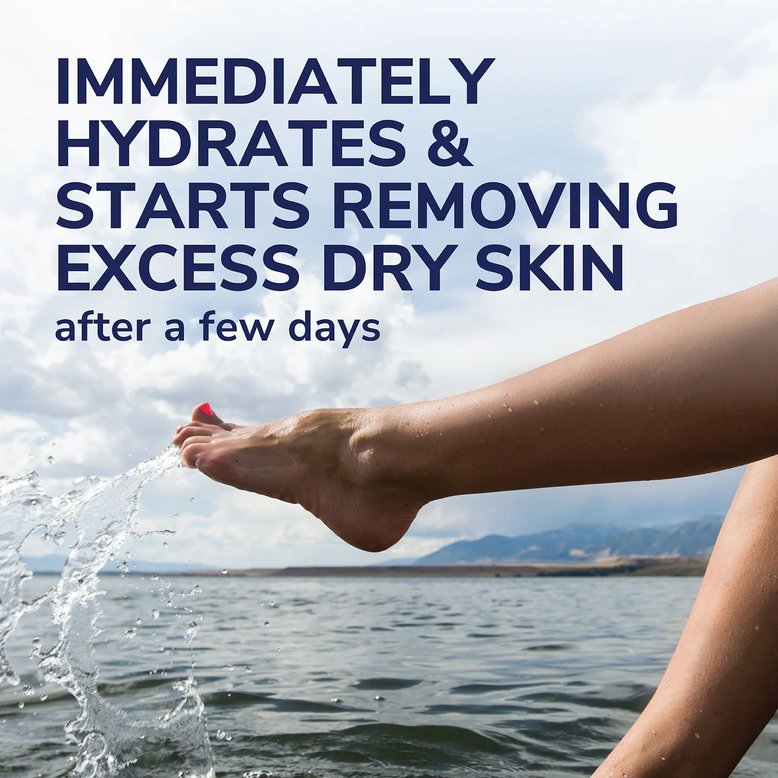 Dr.Scholl Dry, Flaky Skin Remover Ultra Exfoliating Foot Lotion