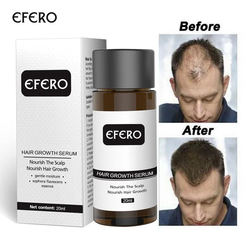 EFERO 20ML Ginseng Hair Growth Essence Treatment Prevent Hair Loss Product For Men Women Fast Powerful Hair Growth Serum Care