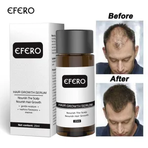 EFERO 20ML Ginseng Hair Growth Essence Treatment Prevent Hair Loss Product For Men Women Fast Powerful Hair Growth Serum Care