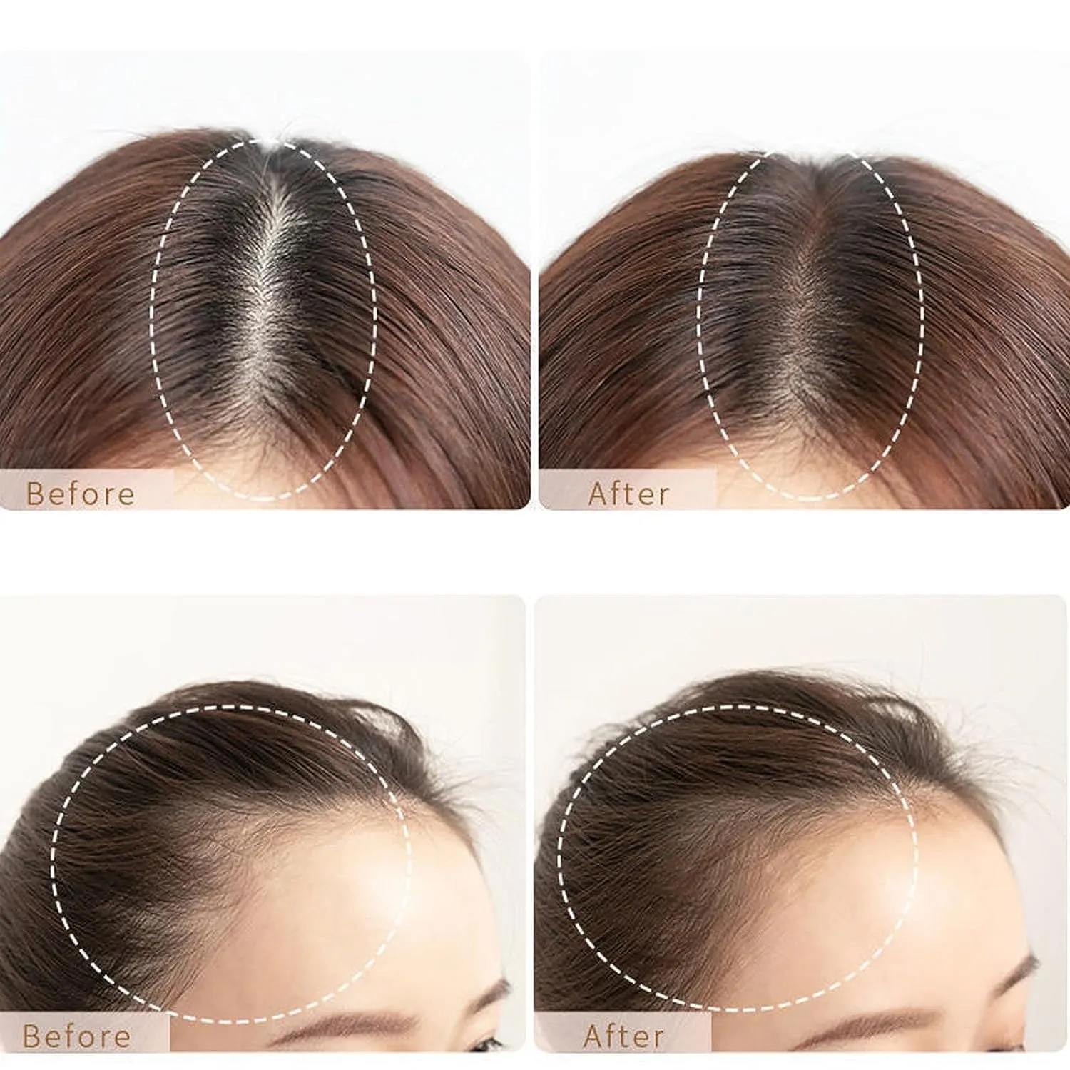 Enhance Hairline Powder - Instantly Conceals Roots and Touch-Up (Dark Brown, Medium)