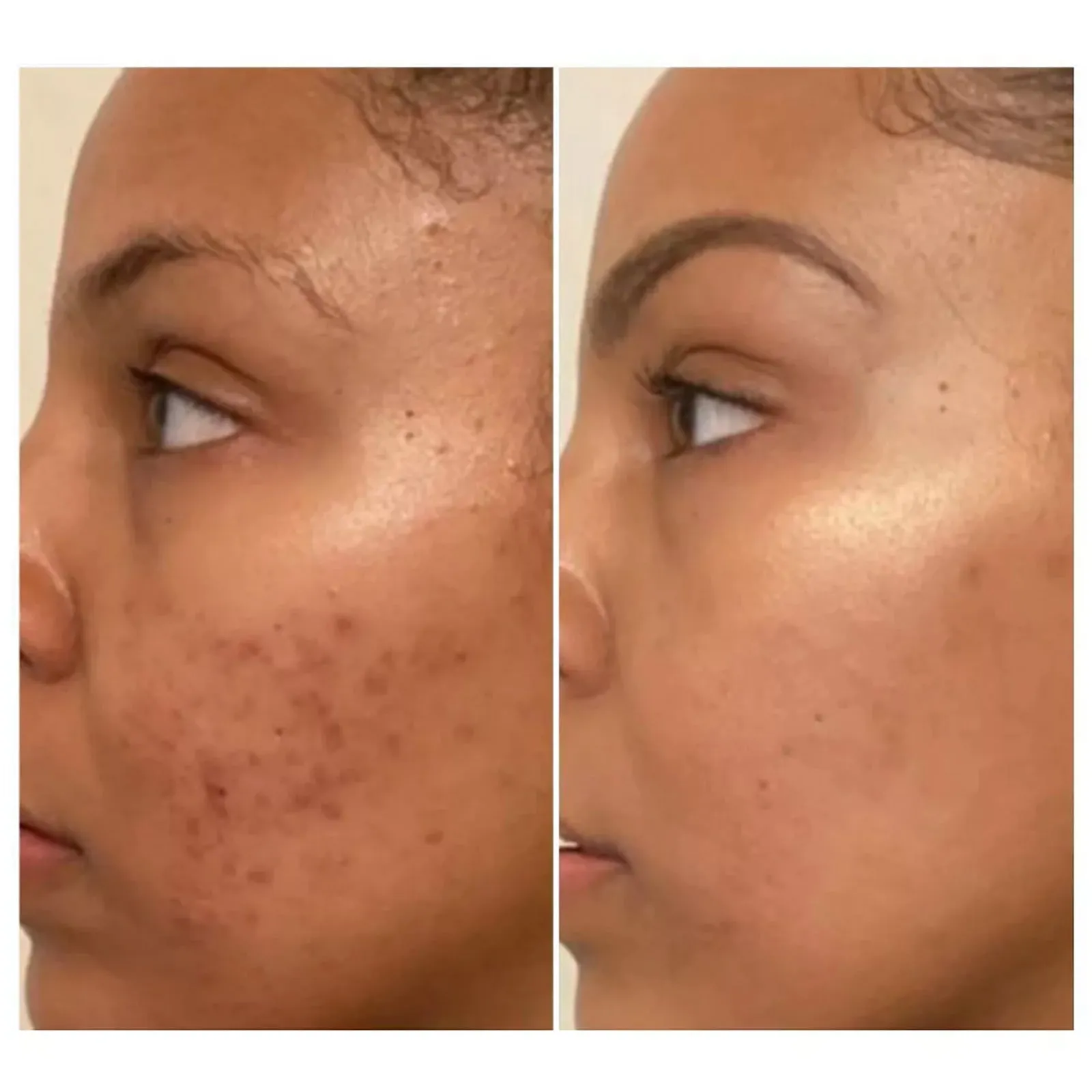 Even Glow Brightening 3-Step Trio