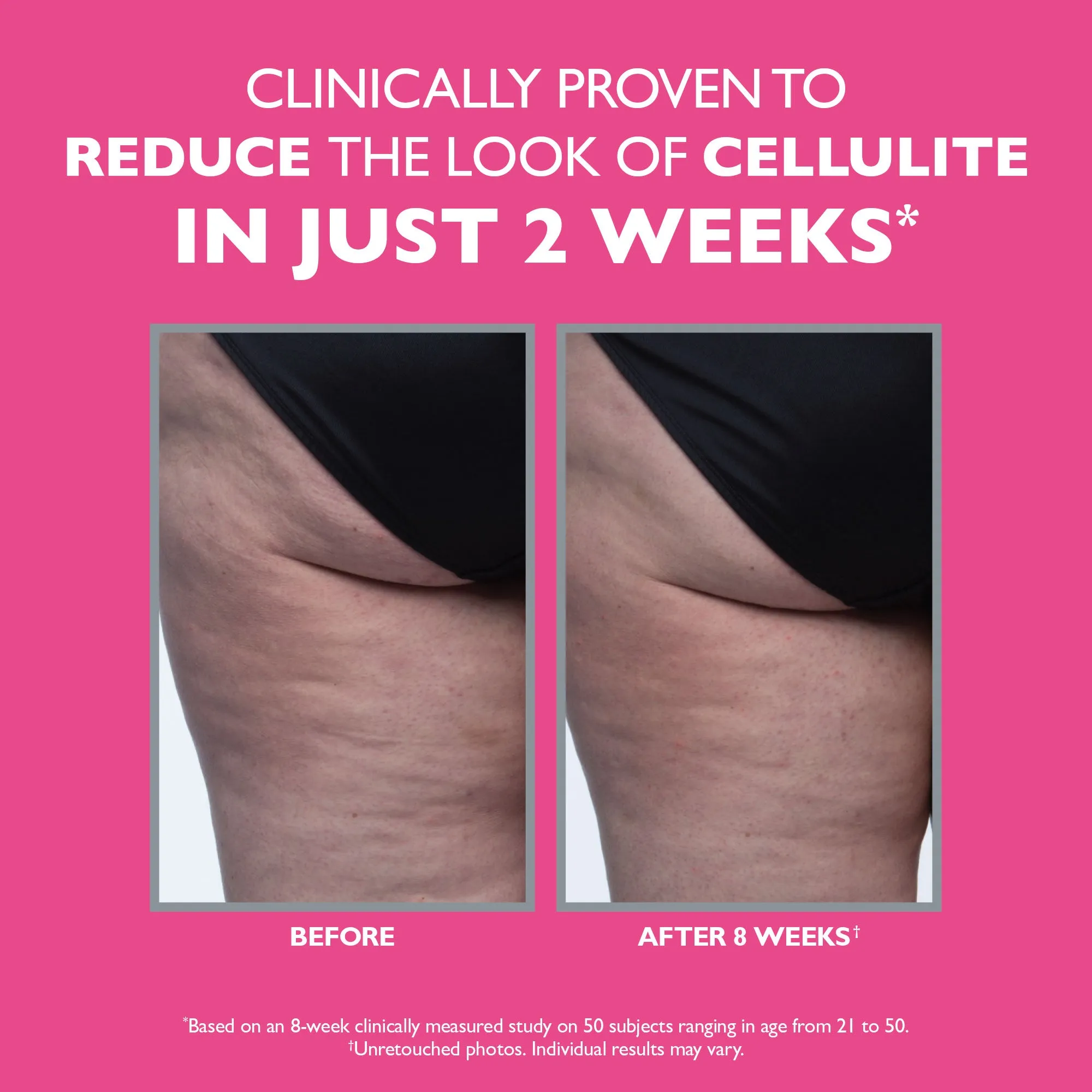 FIRMx® Tight & Toned Cellulite Treatment