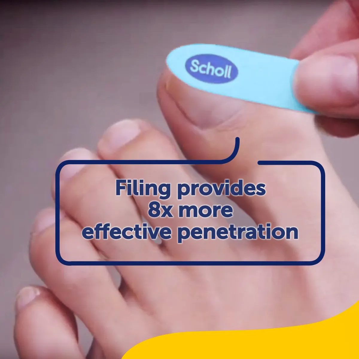 Fungal Nail Treatment