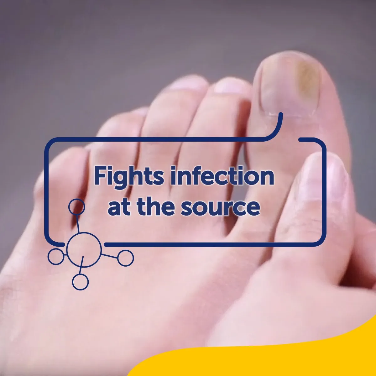Fungal Nail Treatment