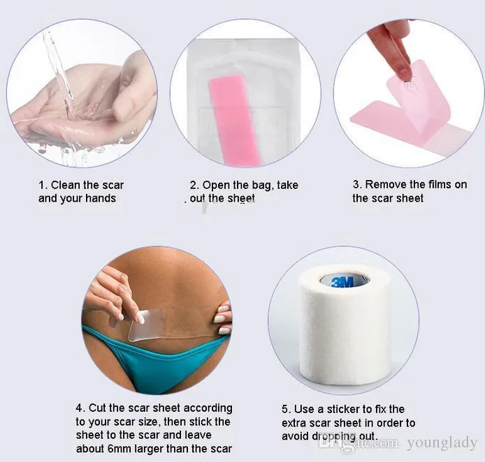 Gel Scar Therapy Patch