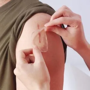Gel Scar Therapy Patch