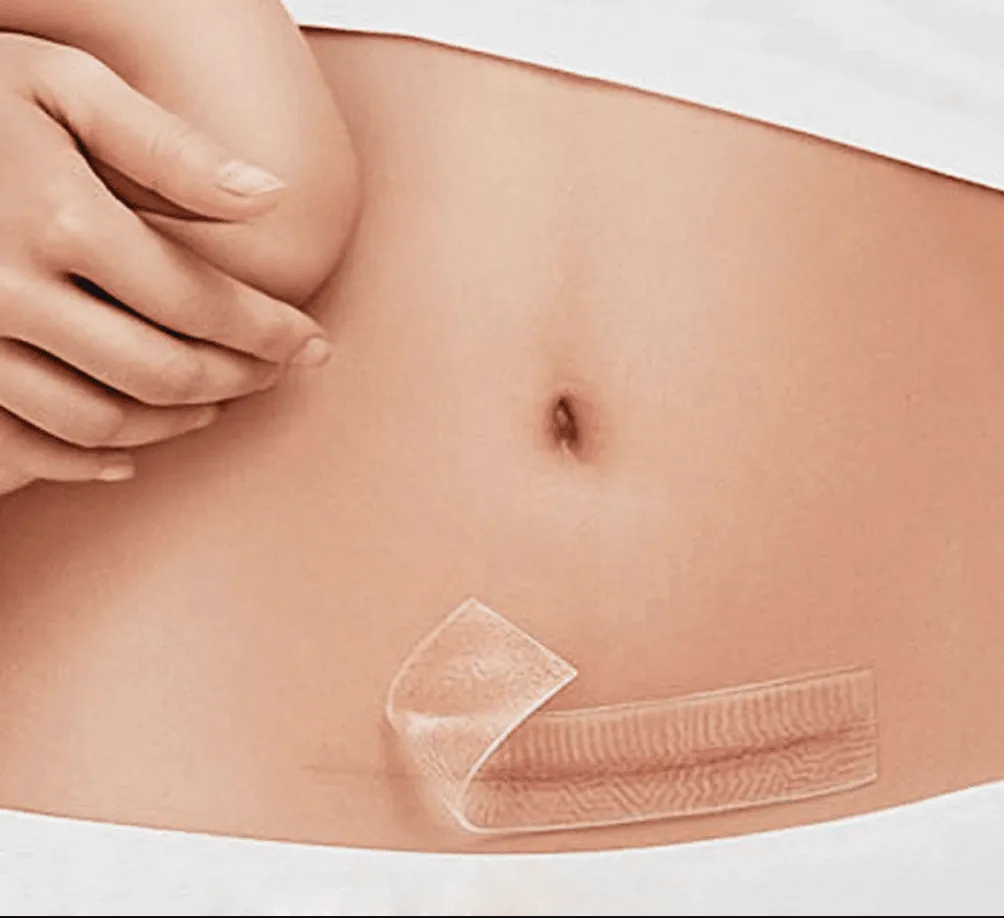 Gel Scar Therapy Patch