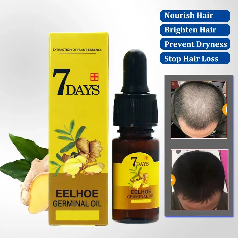 Ginger Hair Growth Essential Oil Serum Hair Regrowth 7 Days Anti-Loss Repair Strong Roots Hair Care