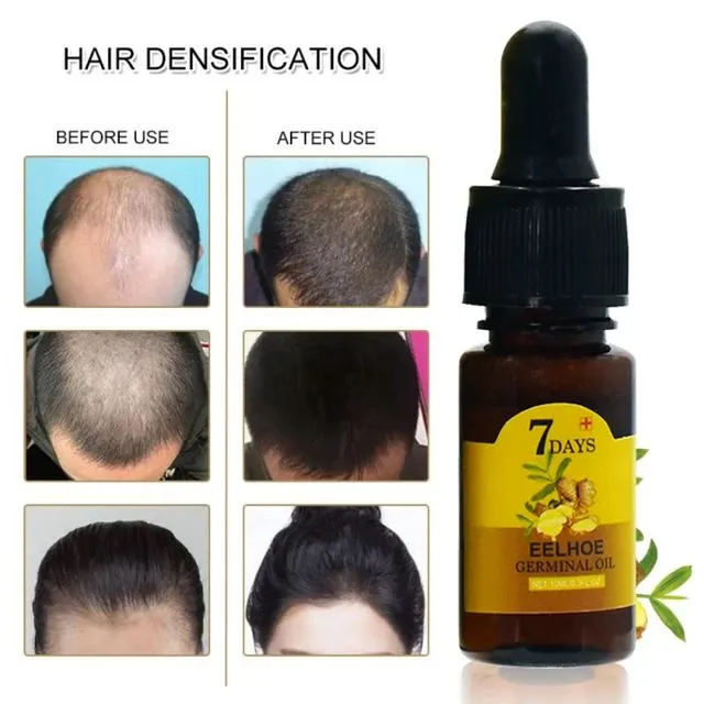 Ginger Hair Growth Essential Oil Serum Hair Regrowth 7 Days Anti-Loss Repair Strong Roots Hair Care