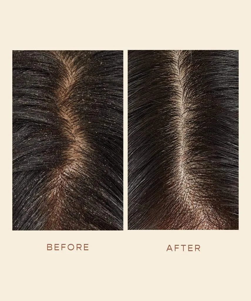 GRO Scalp Detoxifying Serum