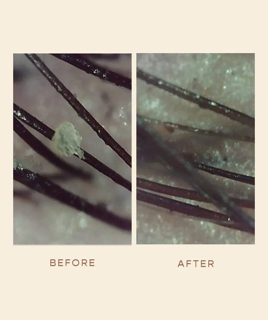 GRO Scalp Detoxifying Serum
