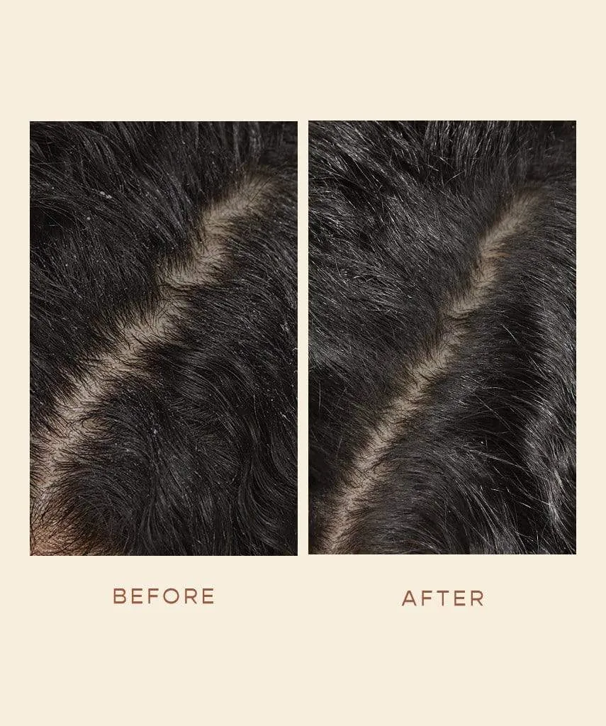GRO Scalp Detoxifying Serum