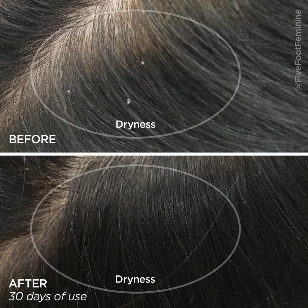 Healthy Scalp Serum Hair Density Treatment
