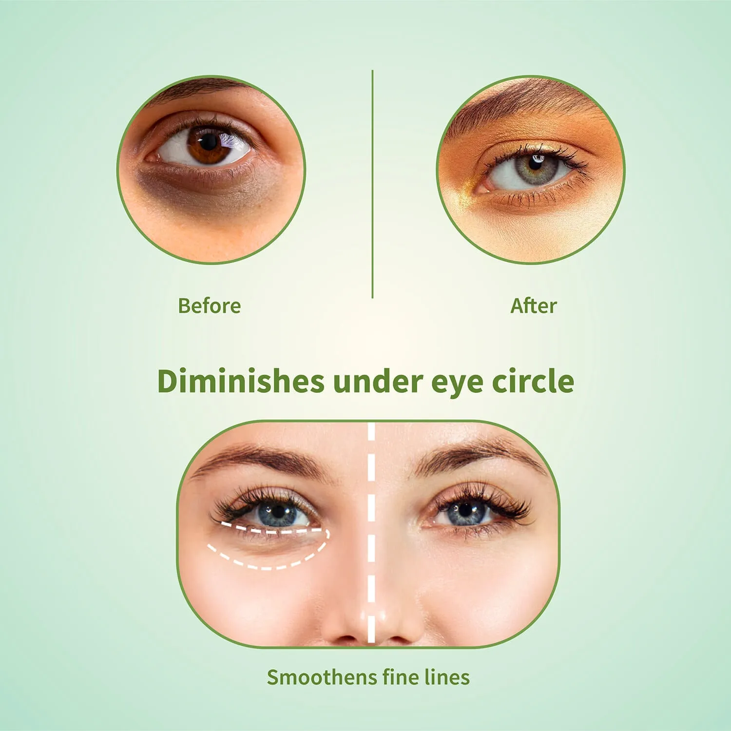 Hemp Seed Under Eye Gel For Reducing Dark Circles ( Net Qty -15ml)