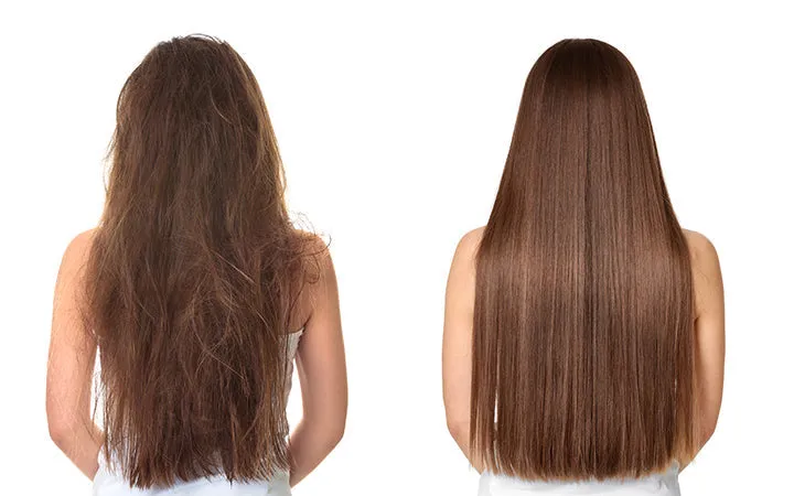 Hyaluronic Acid  Hair Treatment