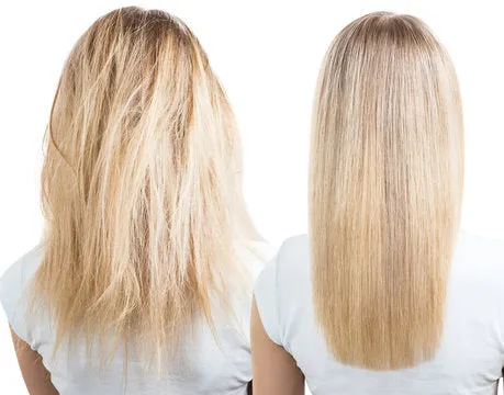 Hyaluronic Acid  Hair Treatment