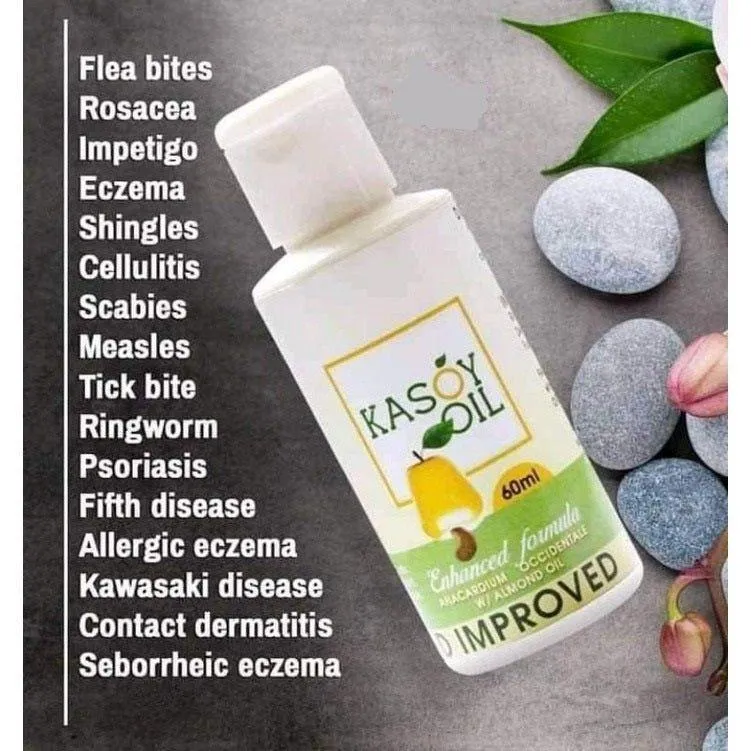 Kasoy Oil Enhanced Formula - 60ml