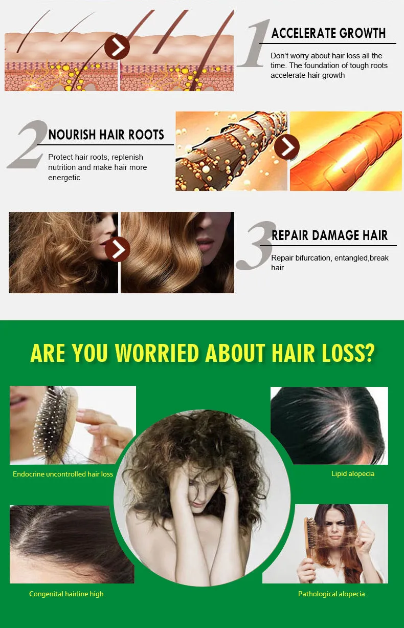 King Of Ginger 7 Days Ginger Germinal Oil Hair Tonic Growth Essence Anti-Fall Hair Treatment Care