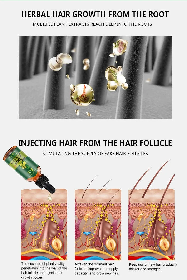 King Of Ginger 7 Days Ginger Germinal Oil Hair Tonic Growth Essence Anti-Fall Hair Treatment Care