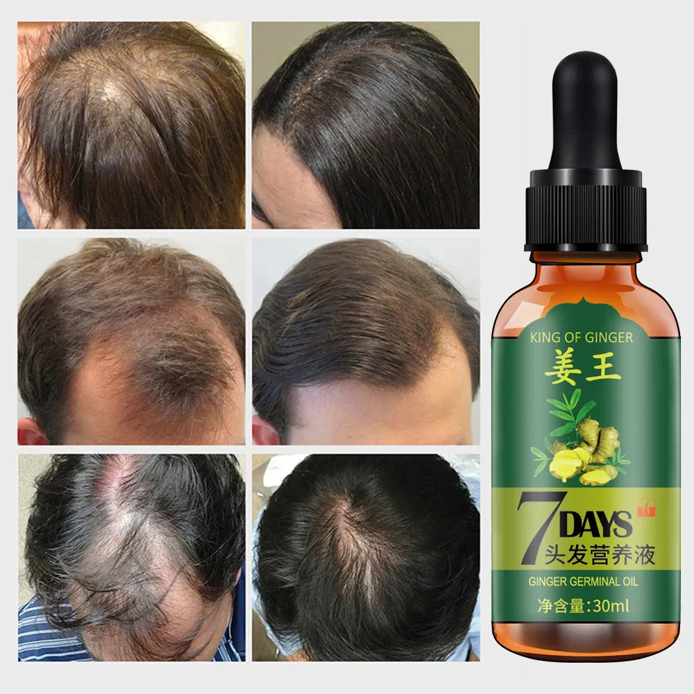 King Of Ginger 7 Days Ginger Germinal Oil Hair Tonic Growth Essence Anti-Fall Hair Treatment Care
