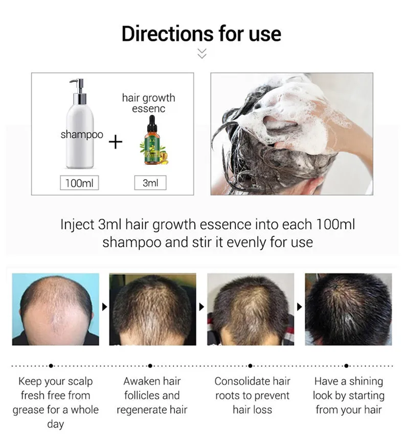 King Of Ginger 7 Days Ginger Germinal Oil Hair Tonic Growth Essence Anti-Fall Hair Treatment Care