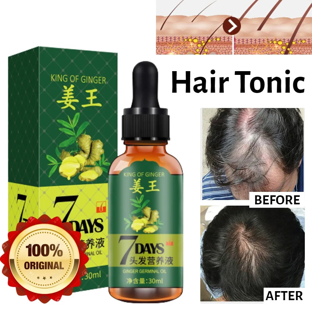King Of Ginger 7 Days Ginger Germinal Oil Hair Tonic Growth Essence Anti-Fall Hair Treatment Care