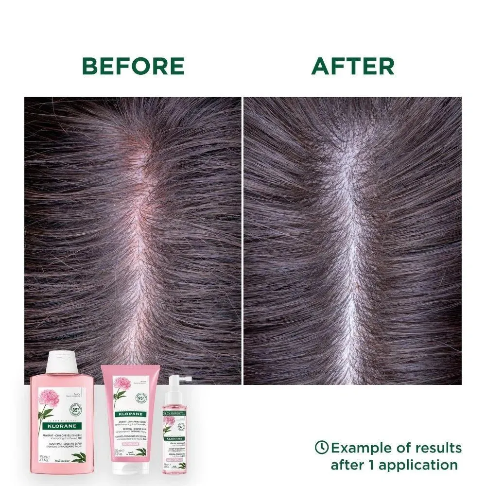 Klorane treatment for sensitive scalp